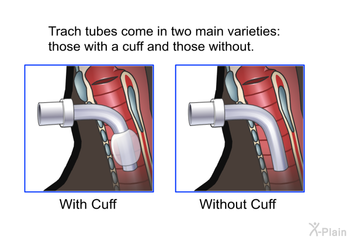 Trach tubes come in two main varieties: those with a cuff and those without.