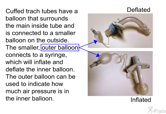 Cuffed trach tubes have a balloon that surrounds the main inside tube and is connected to a smaller balloon on the outside. The smaller, outer balloon connects to a syringe, which will inflate and deflate the inner balloon. The outer balloon can be used to indicate how much air pressure is in the inner balloon.