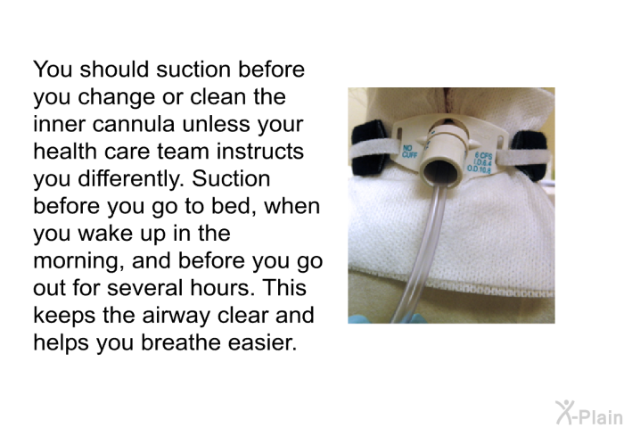 You should suction before you change or clean the inner cannula unless your health care team instructs you differently. Suction before you go to bed, when you wake up in the morning, and before you go out for several hours. This keeps the airway clear and helps you breathe easier.