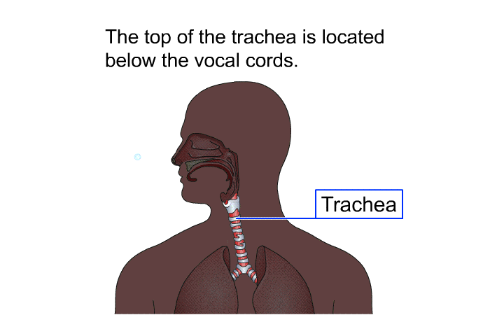 The top of the trachea is located below the vocal cords.