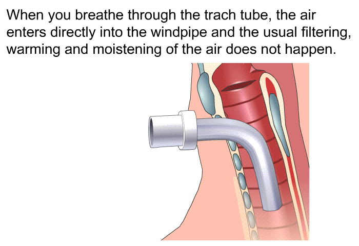 When you breathe through the trach tube, the air enters directly into the windpipe and the usual filtering, warming and moistening of the air does not happen.