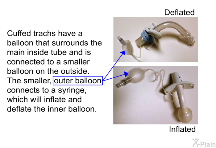 Cuffed trachs have a balloon that surrounds the main inside tube and is connected to a smaller balloon on the outside. The smaller, outer balloon connects to a syringe, which will inflate and deflate the inner balloon.