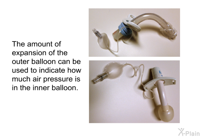 The amount of expansion of the outer balloon can be used to indicate how much air pressure is in the inner balloon.