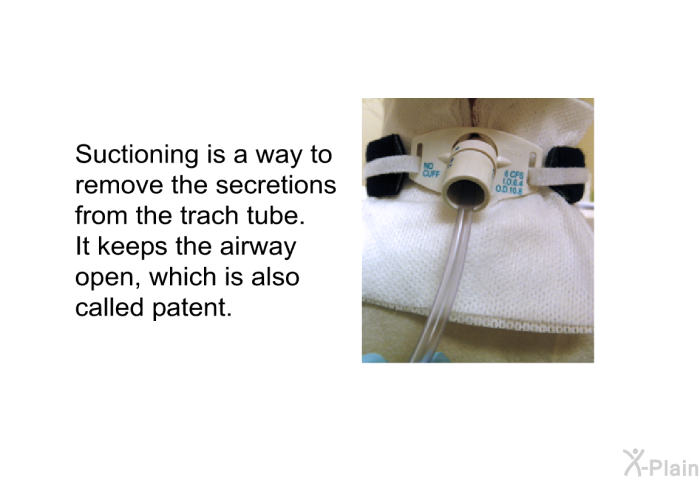 Suctioning is a way to remove the secretions from the trach tube. It keeps the airway open, which is also called patent.