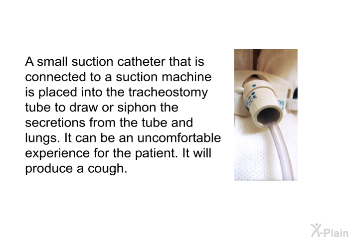A small suction catheter that is connected to a suction machine is placed into the tracheostomy tube to draw or siphon the secretions from the tube and lungs. It can be an uncomfortable experience for the patient. It will produce a cough.