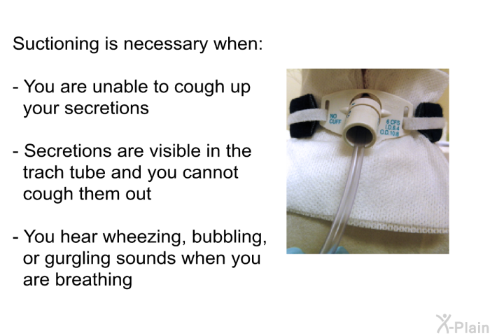 Suctioning is necessary when:  You are unable to cough up your secretions. Secretions are visible in the trach tube and you cannot cough them out. You hear wheezing, bubbling or gurgling sounds when you are breathing.