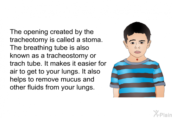 The opening created by the tracheotomy is called a stoma. The breathing tube is also known as a tracheostomy or trach tube. It makes it easier for air to get to your lungs. It also helps to remove mucus and other fluids from your lungs.
