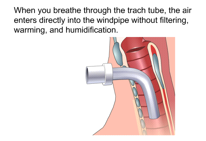 When you breathe through the trach tube, the air enters directly into the windpipe without filtering, warming, and humidification.