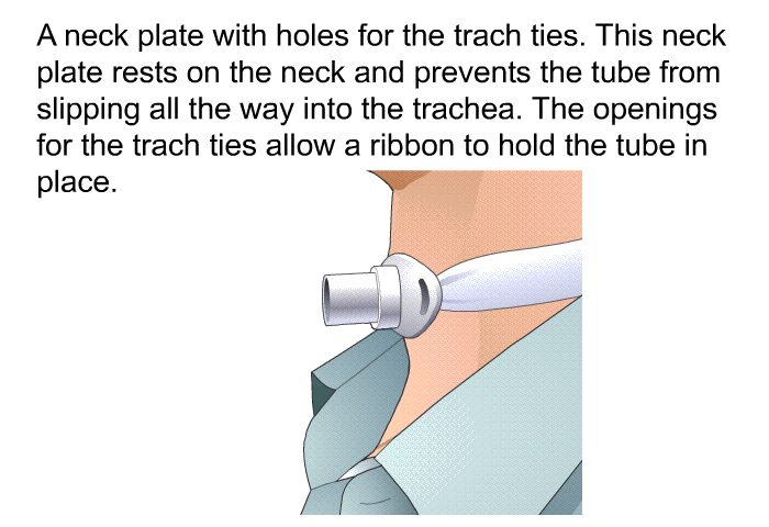 A neck plate with holes for the trach ties. This neck plate rests on the neck and prevents the tube from slipping all the way into the trachea. The openings for the trach ties allow a ribbon to hold the tube in place.