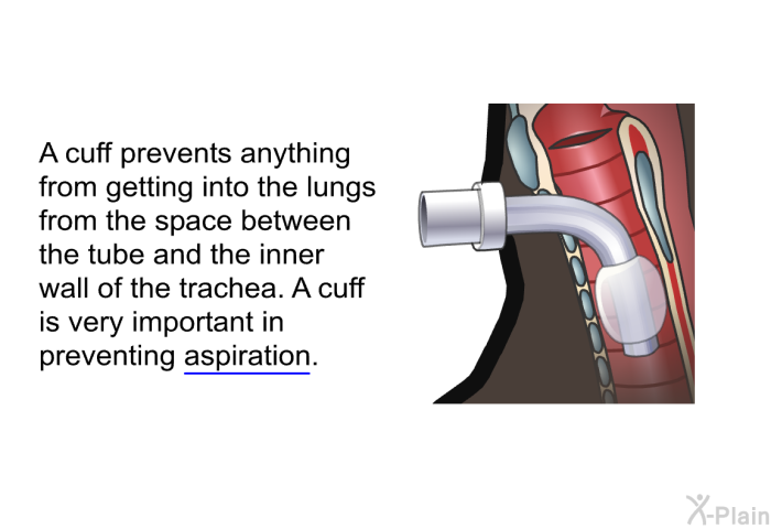 A cuff prevents anything from getting into the lungs from the space between the tube and the inner wall of the trachea. A cuff is very important in preventing aspiration.