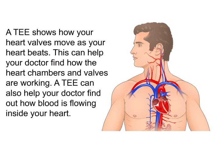 A TEE shows how your heart valves move as your heart beats. This can help your doctor find how the heart chambers and valves are working. A TEE can also help your doctor find out how blood is flowing inside your heart.