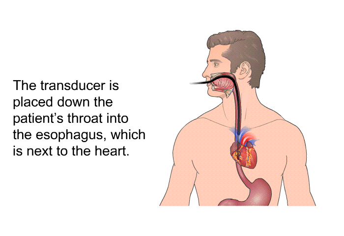 The transducer is placed down the patient's throat into the esophagus, which is next to the heart.