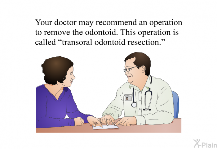 Your doctor may recommend an operation to remove the odontoid. This operation is called “transoral odontoid resection.”