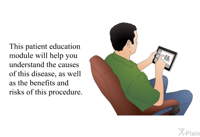 This health information will help you understand the causes of this disease, as well as the benefits and risks of this procedure.