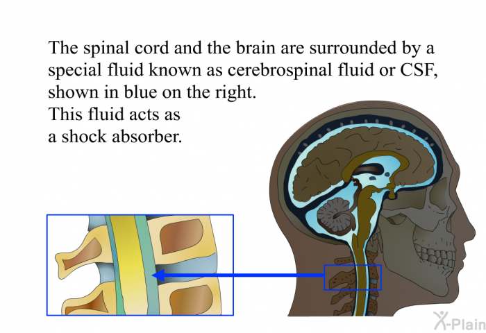 The spinal cord and the brain are surrounded by a special fluid known as cerebrospinal fluid or CSF, shown in blue on the right. This fluid acts as a shock absorber.
