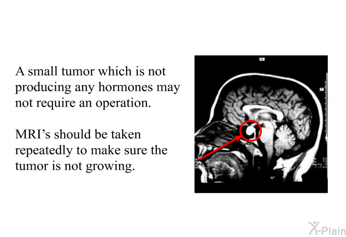 A small tumor which is not producing any hormones may not require an operation. MRI's should be taken repeatedly to make sure the tumor is not growing.
