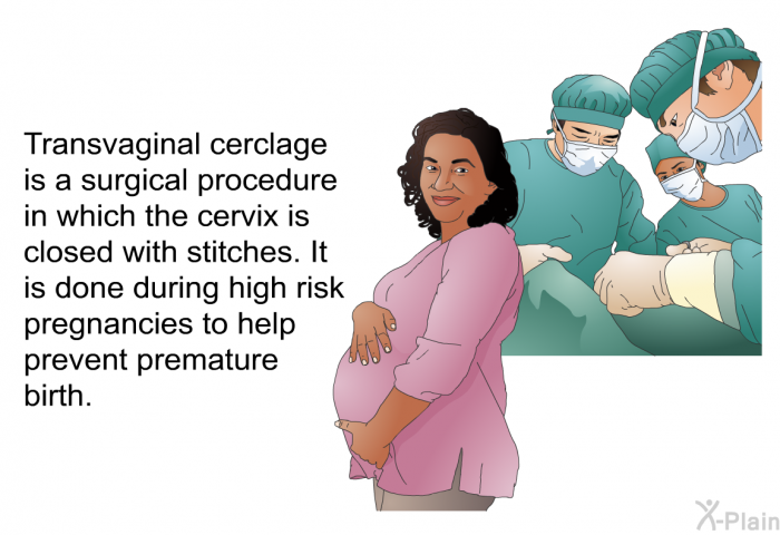 Transvaginal cerclage is a surgical procedure in which the cervix is closed with stitches. It is done during high risk pregnancies to help prevent premature birth.