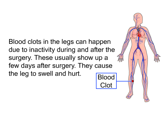 Blood clots in the legs can happen due to inactivity during and after the surgery. These usually show up a few days after surgery. They cause the leg to swell and hurt.