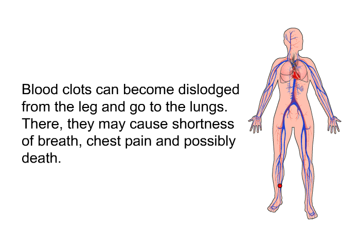 Blood clots can become dislodged from the leg and go to the lungs. There, they may cause shortness of breath, chest pain and possibly death.