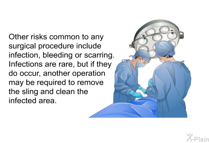 Other risks common to any surgical procedure include infection, bleeding or scarring. Infections are rare, but if they do occur, another operation may be required to remove the sling and clean the infected area.