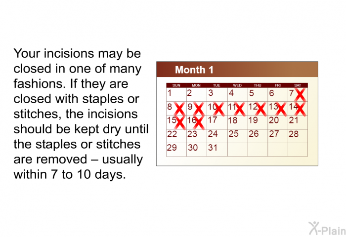 Your incisions may be closed in one of many fashions. If they are closed with staples or stitches, the incisions should be kept dry until the staples or stitches are removed &ndash; usually within 7 to 10 days.