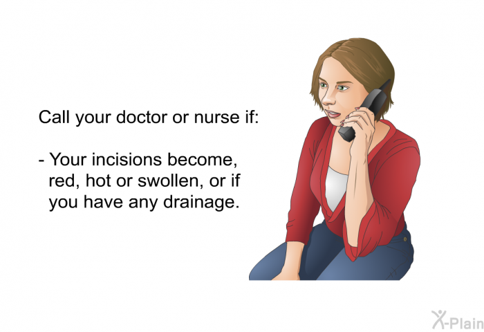 Call your doctor or nurse if:  Your incisions become, red, hot or swollen, or if you have any drainage