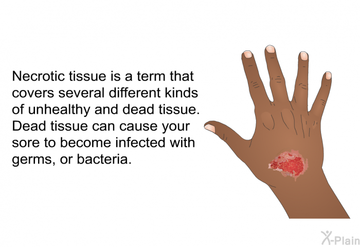 Necrotic tissue is a term that covers several different kinds of unhealthy and dead tissue. Dead tissue can cause your sore to become infected with germs, or bacteria.