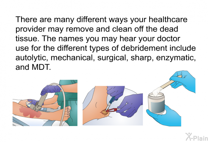 There are many different ways your healthcare provider may remove and clean off the dead tissue. The names you may hear your doctor use for the different types of debridement include autolytic, mechanical, surgical, sharp, enzymatic, and MDT.