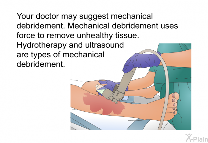 Your doctor may suggest mechanical debridement. Mechanical debridement uses force to remove unhealthy tissue. Hydrotherapy and ultrasound are types of mechanical debridement.