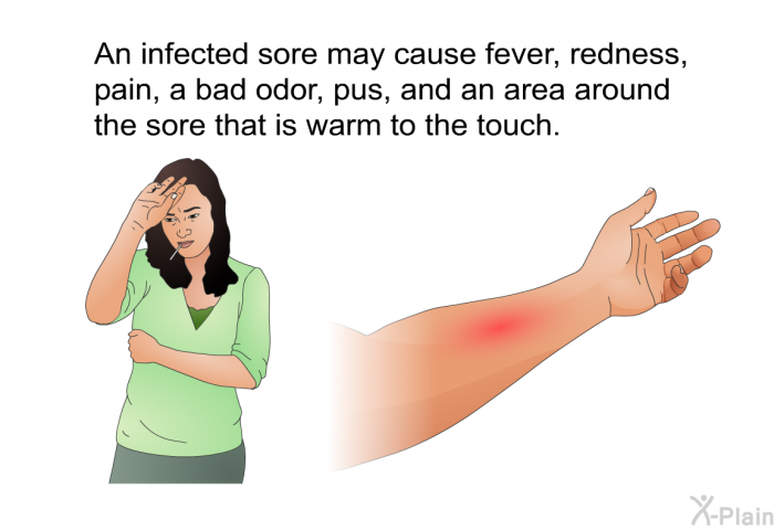 An infected sore may cause fever, redness, pain, a bad odor, pus, and an area around the sore that is warm to the touch.