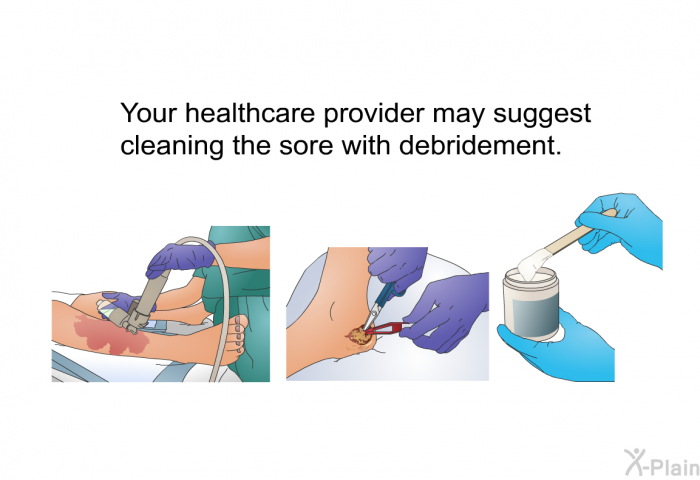 Your healthcare provider may suggest cleaning the sore with debridement.
