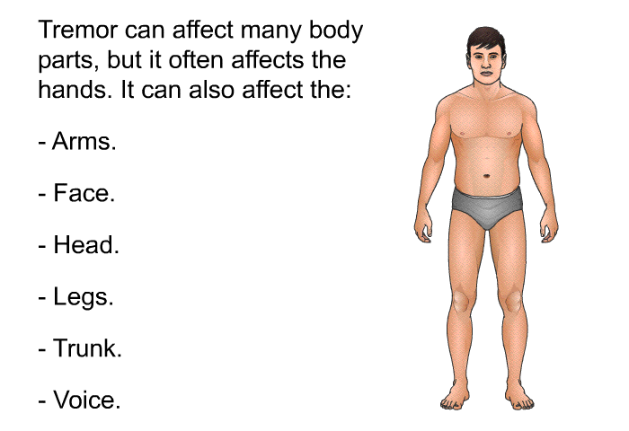 Tremor can affect many body parts, but it often affects the hands. It can also affect the:  Arms. Face. Head. Legs. Trunk. Voice.