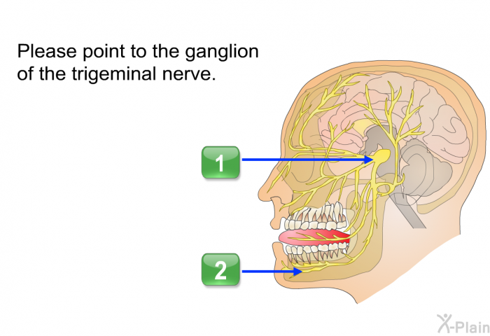Please point to the ganglion of the trigeminal nerve. Press A or B