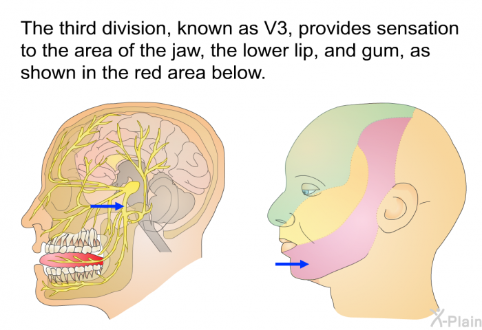 The third division, known as V3, provides sensation to the area of the jaw, the lower lip, and gum, as shown in the red area below.