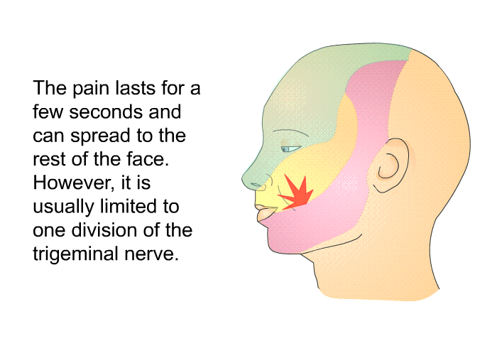 The pain lasts for a few seconds and can spread to the rest of the face. However, it is usually limited to one division of the trigeminal nerve.