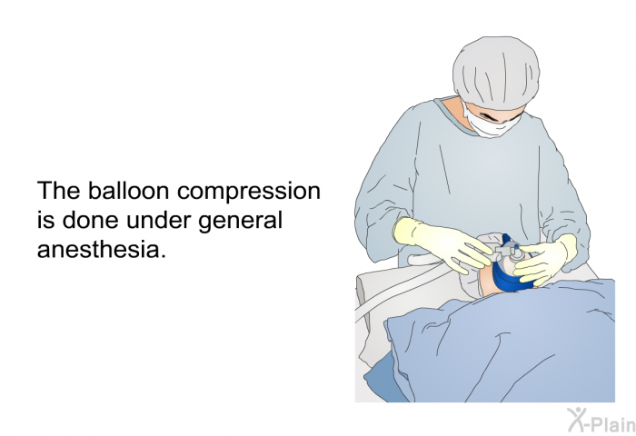 The balloon compression is done under general anesthesia.