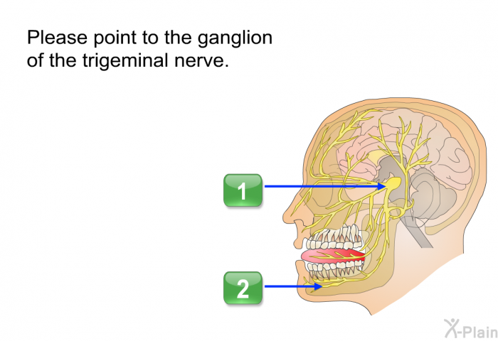 Please point to the ganglion of the trigeminal nerve.