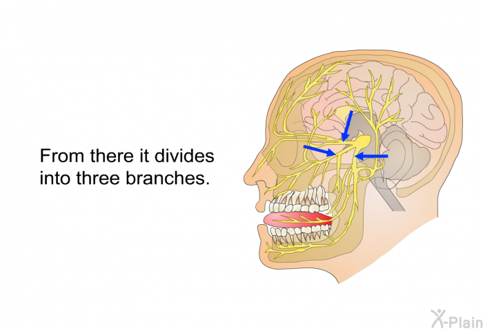 From there it divides into three branches.