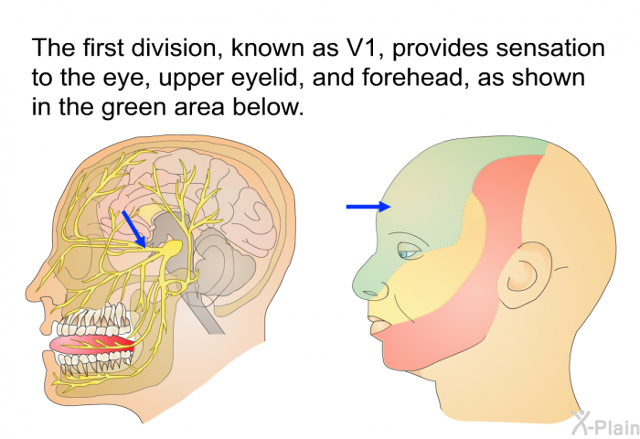 The first division, known as V1, provides sensation to the eye, upper eyelid, and forehead, as shown in the green area below.
