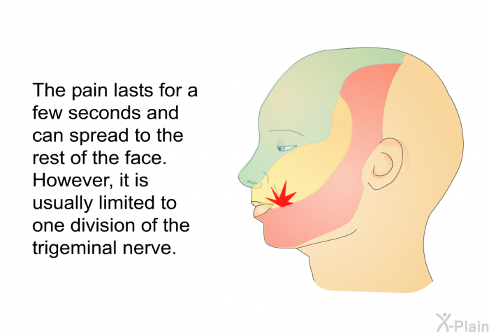 The pain lasts for a few seconds and can spread to the rest of the face. However, it is usually limited to one division of the trigeminal nerve.