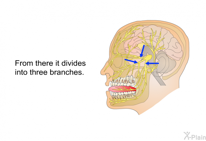 From there it divides into three branches.