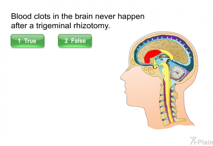 Blood clots in the brain never happen after a trigeminal rhizotomy. Press True or False.