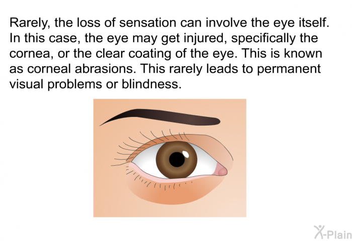 Rarely, the loss of sensation can involve the eye itself. In this case, the eye may get injured, specifically the cornea, or the clear coating of the eye. This is known as corneal abrasions. This rarely leads to permanent visual problems or blindness.