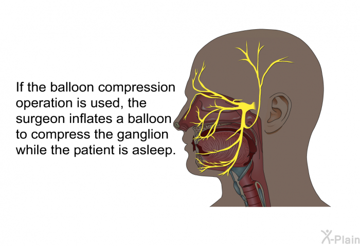 If the balloon compression operation is used, the surgeon inflates a balloon to compress the ganglion while the patient is asleep.