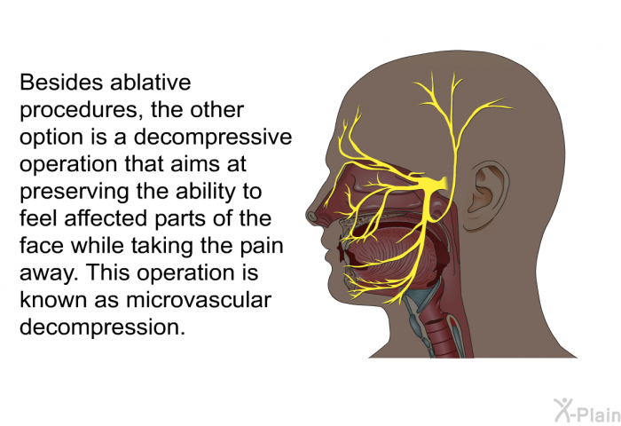 Besides ablative procedures, the other option is a decompressive operation that aims at preserving the ability to feel affected parts of the face while taking the pain away. This operation is known as microvascular decompression.