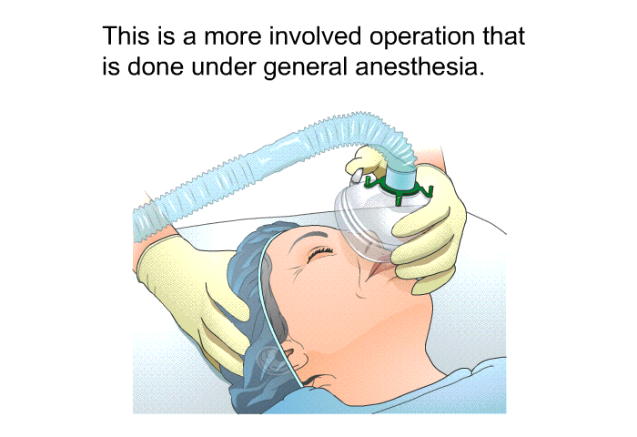 This is a more involved operation that is done under general anesthesia.