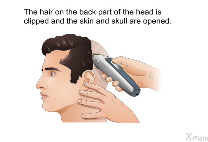 The hair on the back part of the head is clipped and the skin and skull are opened.