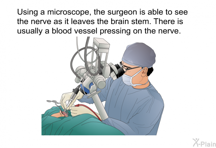 Using a microscope, the surgeon is able to see the nerve as it leaves the brain stem. There is usually a blood vessel pressing on the nerve.