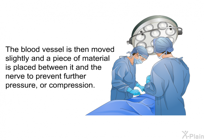 The blood vessel is then moved slightly and a piece of material is placed between it and the nerve to prevent further pressure, or compression.