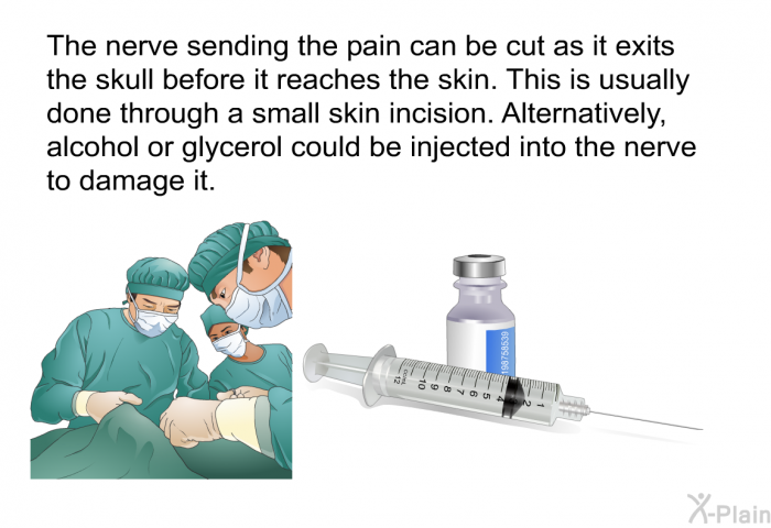 The nerve sending the pain can be cut as it exits the skull before it reaches the skin. This is usually done through a small skin incision. Alternatively, alcohol or glycerol could be injected into the nerve to damage it.